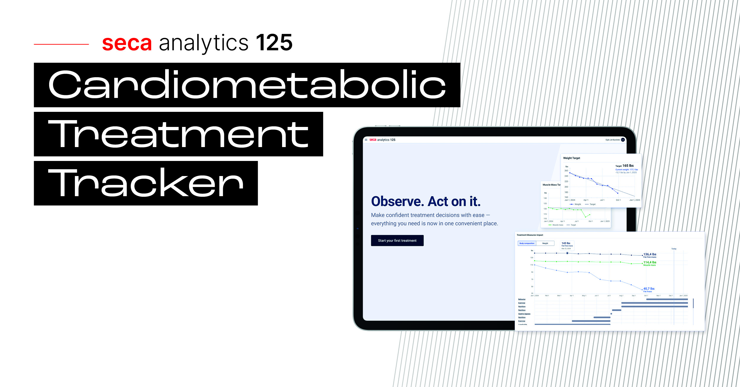 seca Unveils First-Of-Its-Kind ‘Treatment Tracker’ to Directly Link Patient Treatment Plans with Body Composition Data
